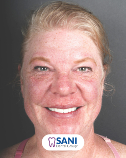 After from Melissa Harris